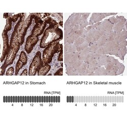 ARHGAP12 Antibody, Novus Biologicals:Antibodies:Primary Antibodies